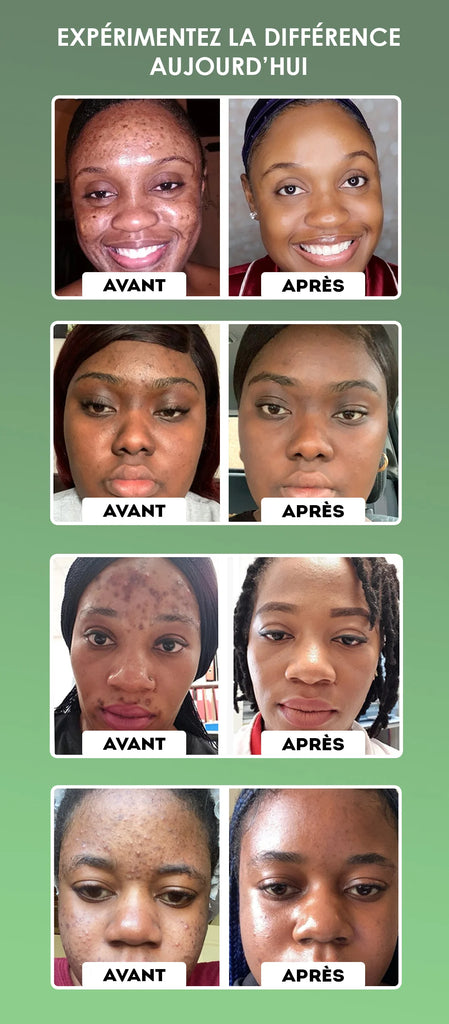 Masque Stick au Thé Vert – Une Peau Nette, Fraîche et Sans Imperfections en Quelques Minutes