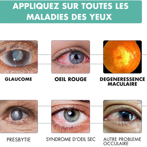 Ophthlamed™ – Dites Adieu aux Yeux Fatigués et Retrouver un Regard Clair en Quelques Secondes
